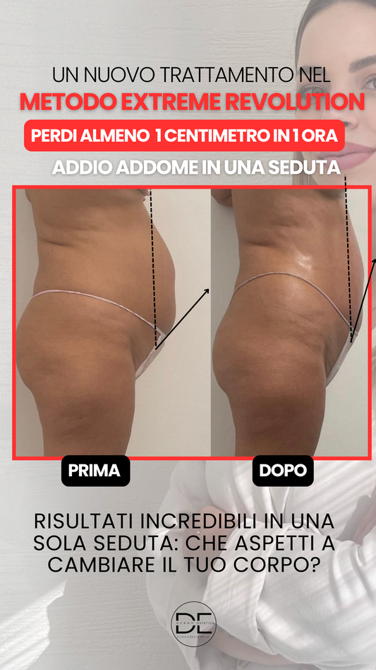 🔥 Perdi almeno 1 cm all’ora con il nuovo protocollo Extreme Revolution™