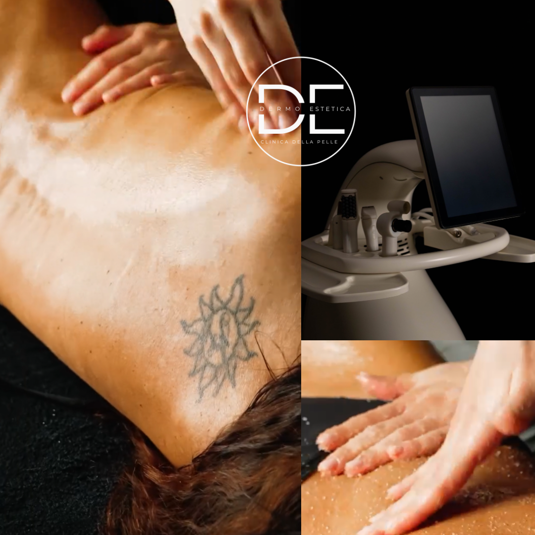Massimizza i risultati: Extreme Body Fit e T-Shape, il duo vincente di Dimensione Estetica
