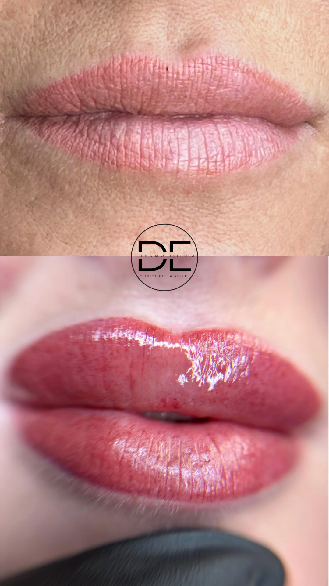 Russian Lips: La Nuova Frontiera del Tatuaggio Labbra da Dimensione Estetica a Varedo
