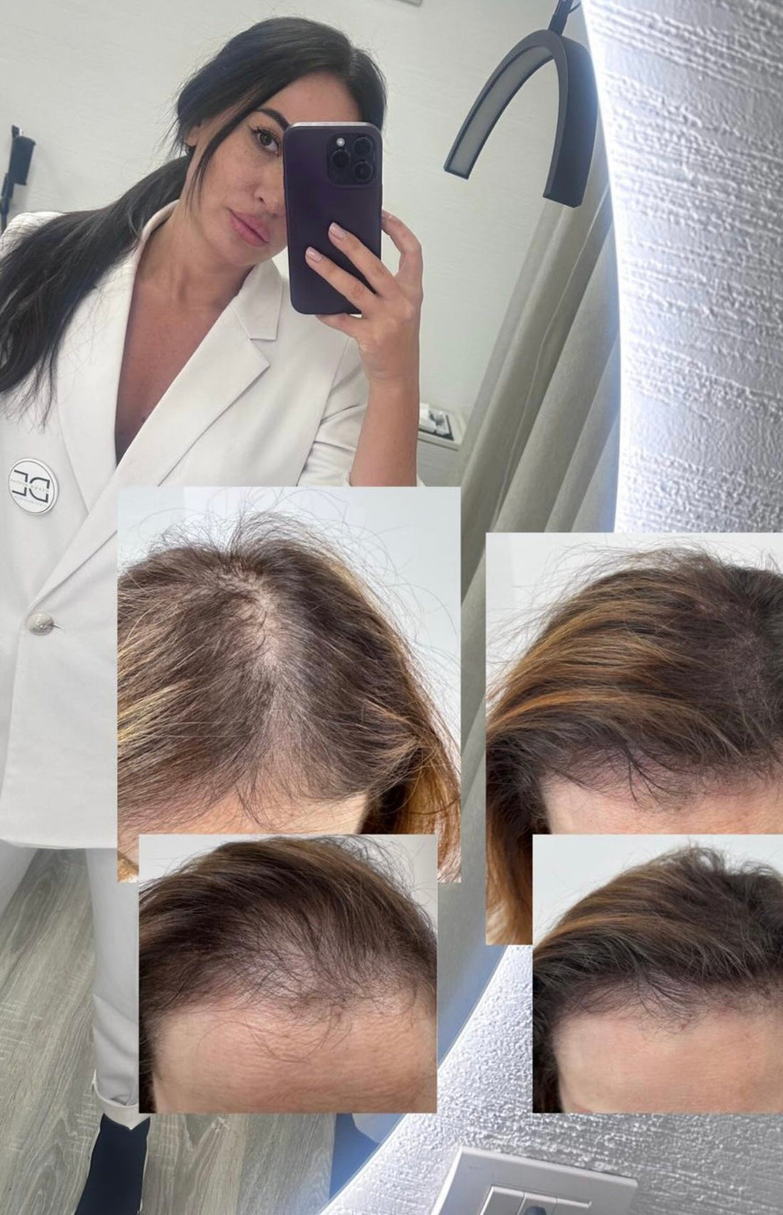 TRICOPIGMENTAZIONE A MONZA E BRIANZA: LA SOLUZIONE DEFINITIVA PER INFOLTIRE I CAPELLI